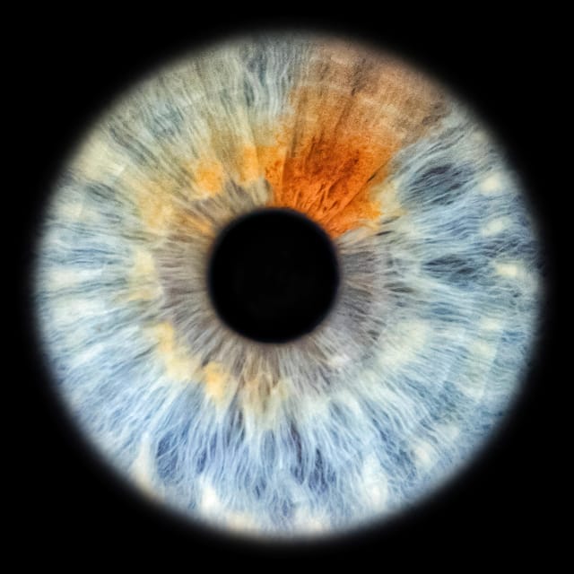 Siracusa Iris Photography Experience - How the session works, take the iris photo, then edit and print